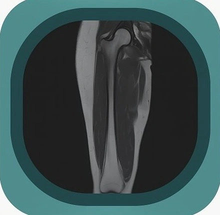 MRI thigh anatomy icon-1771230468